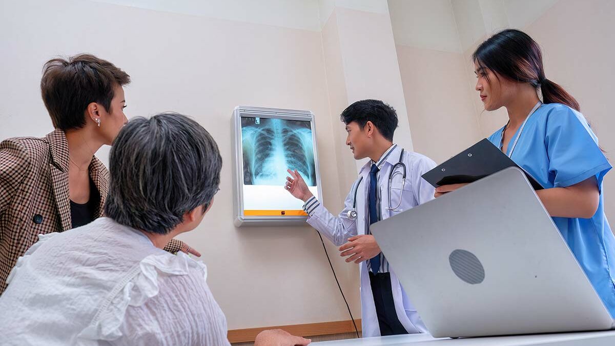 Diagnóstico precoz para el cáncer de pulmón